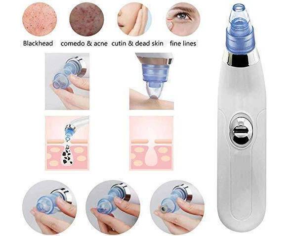 derma-suction-blackheads-remover-device-blackhead-extractor-2-5_1726839450.jpg Blackhead Removal Machine | Derma Suction 3 In 1 Black Head Remover Machine | Acne Pimple Pore Cleaner Vacuum Suction Tool - Image 4